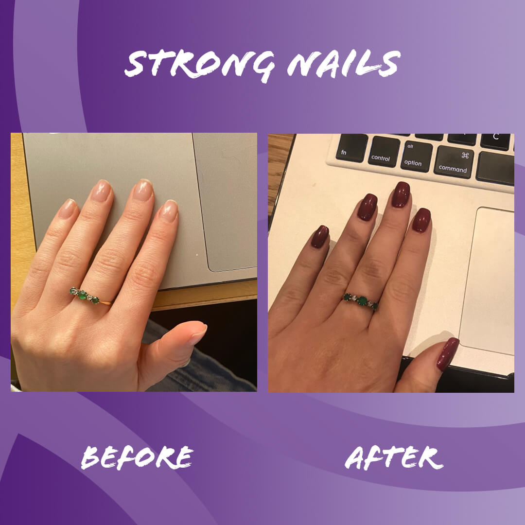 Before and after edible health Collagen Nail growth